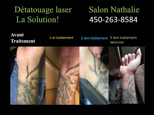 Détatouage Salon nathalie - Thumbnail
