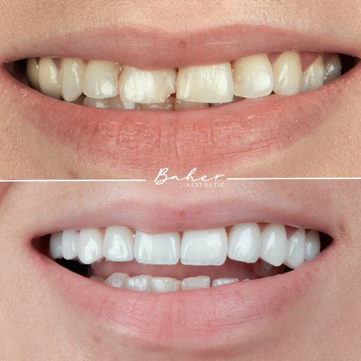 White Dental Nasr city - مركز وايت لطب الاسنان مدينة نصر - صورة 5