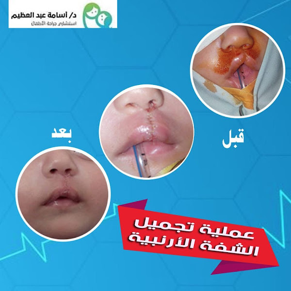 د يمني سعيد عبد العظيم استشاري طب أسنان الأطفال جامعة القاهرة يسعدنا ان نبلغكم بأنه تم إفتتاح Child Mom Care ويمكنكم زيارتنا في مواعيد العمل الموضحه اخر المنشور خدمتنا هي خدمات