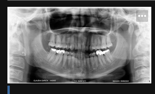 Dentista, odontología general, cosmética dental, implantes ortodoncia - Thumbnail