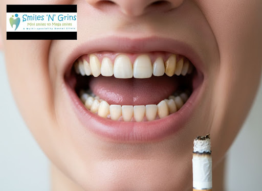 Smoking doesn’t just affect your lungs – it seriously damages your teeth, gums and smile. At Smil… post image