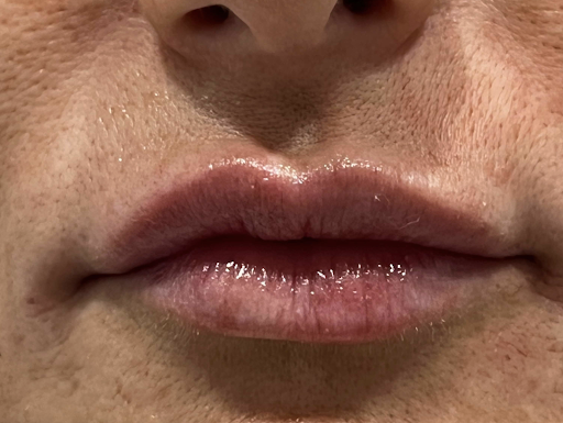 Louisville Aesthetics