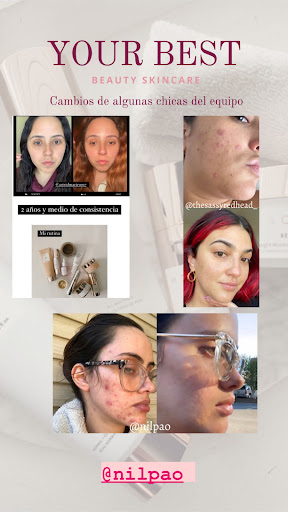 Nilpao heard and skin transformation - Thumbnail