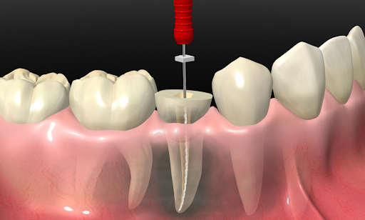 Dr. Daniel Durán - Doctores Dental San Fernando - Thumbnail