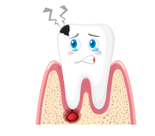 Understanding Dental Abscesses and the Need for Prompt Care post image