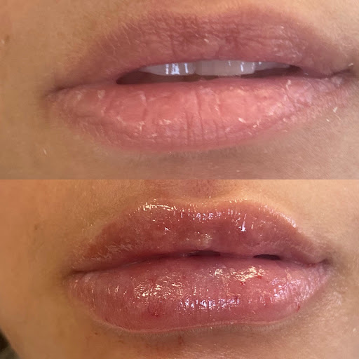 ReVive RX Med Spa