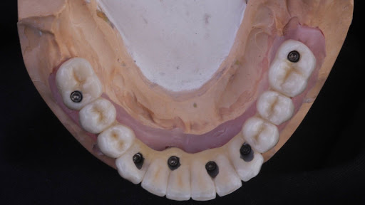 Dental Group Puebla - Thumbnail