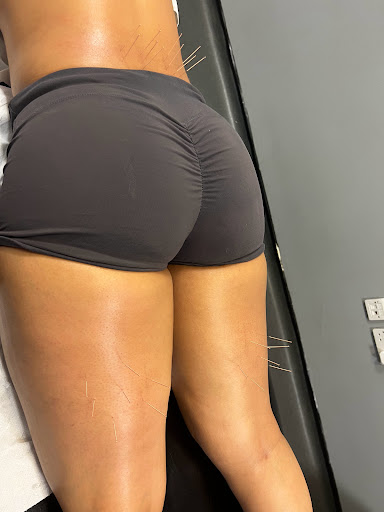 Primal Therapy Colindale Physiotherapy & Sports Injury Clinic - Thumbnail
