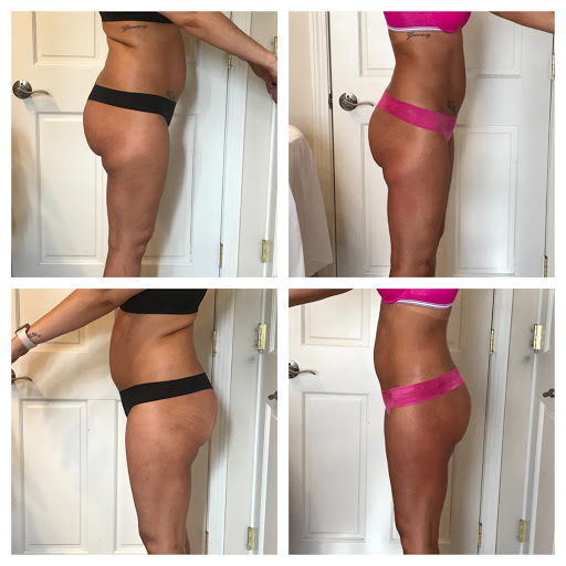 Karin Slimming Massage only for women Gallery - United States