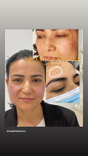 Sadaf Skin Care Mawson Lakes - Thumbnail