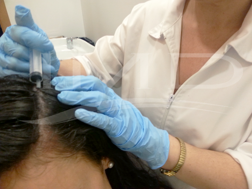 Clínica capilar IMD - Instituto Médico Dermatológico