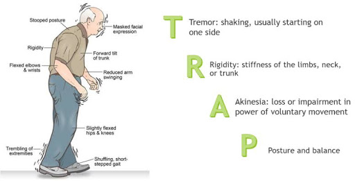 Parkinsonism is a group of Movement relates Disorders.  post image