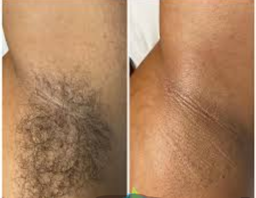 The Wax Lounge & Spa - Thumbnail