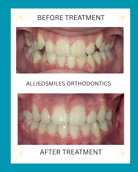 Alliedsmiles Orthodontics photo 2