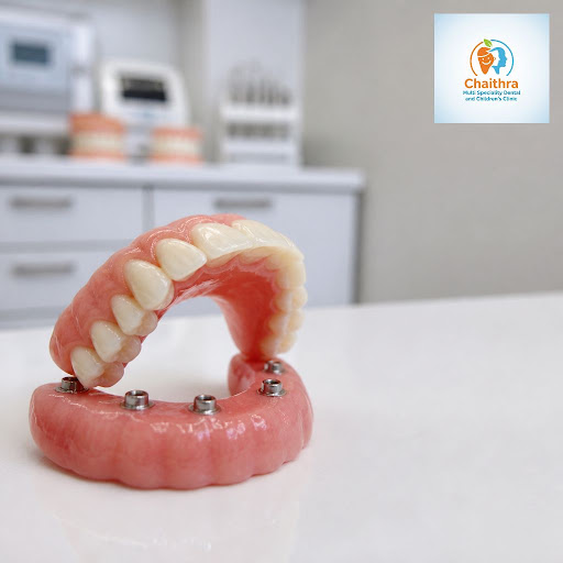 Tired of loose dentures that move when you talk or eat? At Chaithra Multi Speciality Dental and C… post image