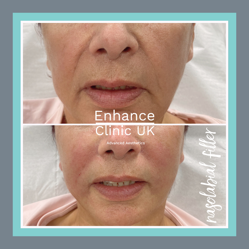 Enhance Clinic UK - Thumbnail