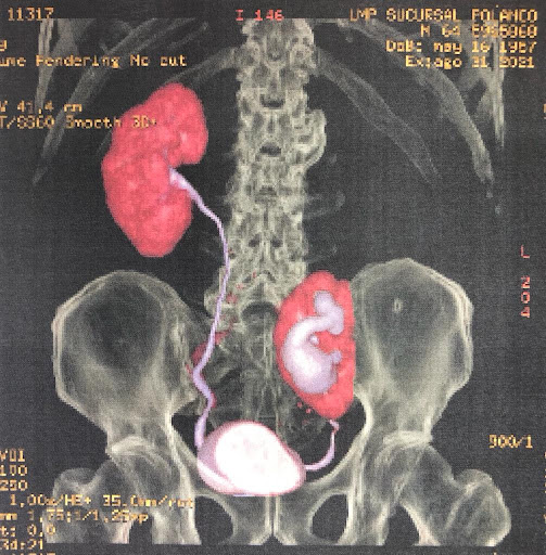 DR. EFIGENIO ANTONIO GARCIA RAMIRO. UROLOGO CERTIFICADO - Thumbnail