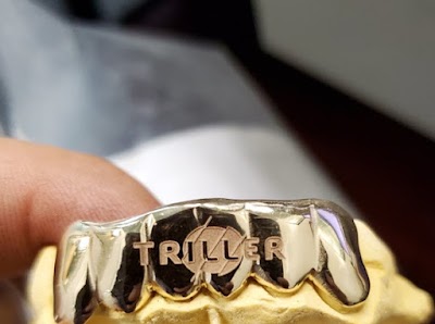 Grillz by Solez