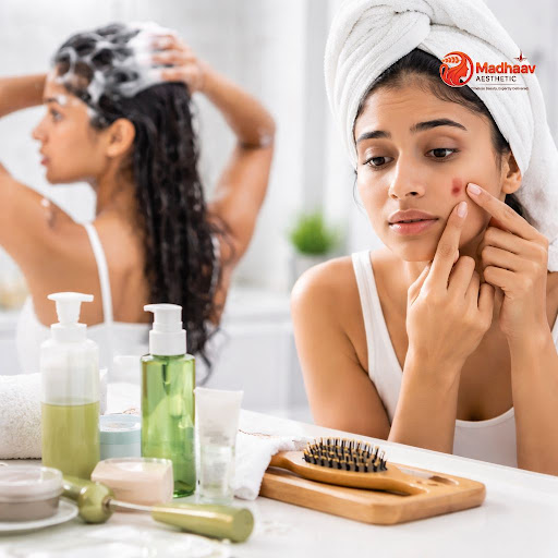 Struggling with persistent acne and greasy scalp despite trying home remedies and over-the-counte… post image