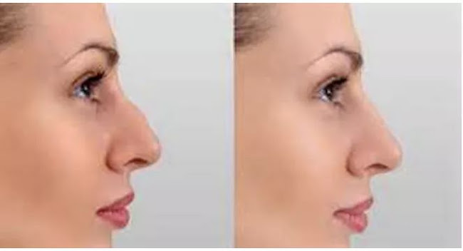 fenix aesthetics & Beauty - Beauty salon