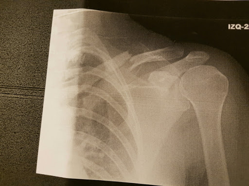 Apps Physiotherapy - Thumbnail
