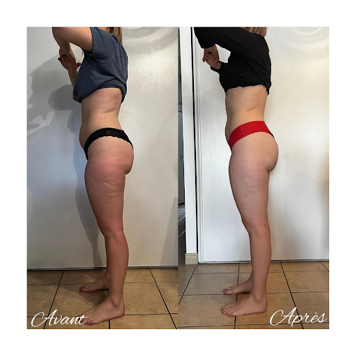 OCÉANE B - Massage à domicile - Drainage Renata Franca - Maderotherapie