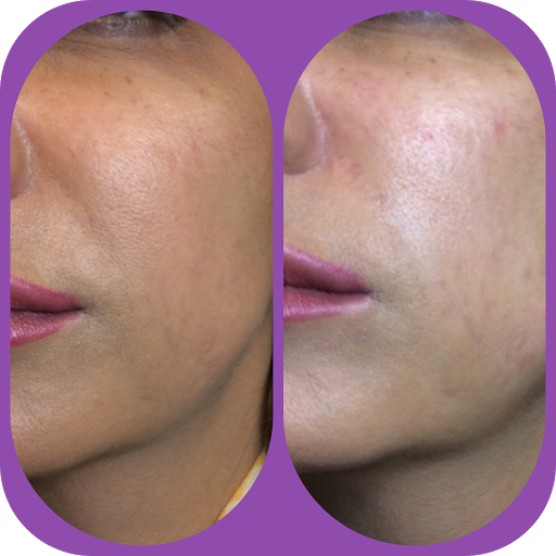 London Professional Aesthetics