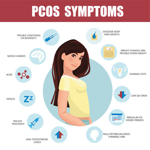 Polycystic ovary syndrome (PCOS) is a common hormonal disorder in women of reproductive age, caus… post image