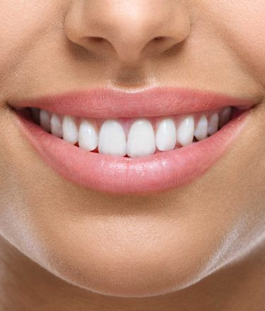 Affordable Dental Implants Downtown Albany