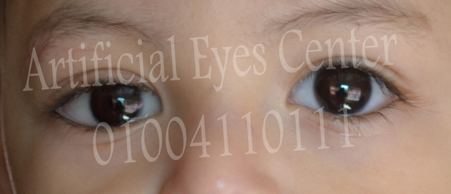 Artificial Eyes Center, Author: مركز العيون الصناعية