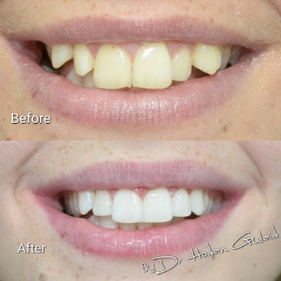 Photos of Smile Dental Clinic Mirdif, Dubai: Best Dental clinic in Mirdif, Dubai, UAE