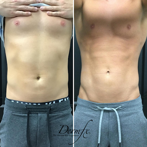 DermFx Redondo Beach - Thumbnail