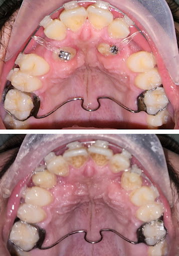 Dr Amr dakroury - صورة 5