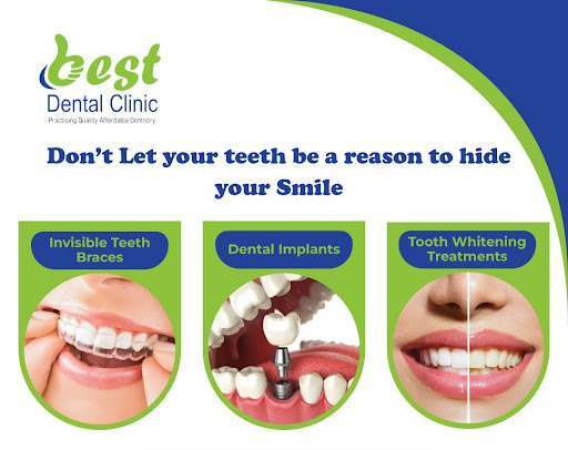If you want to achieve a white smileour dental clinic help with teeth whitening. We are offering… post image