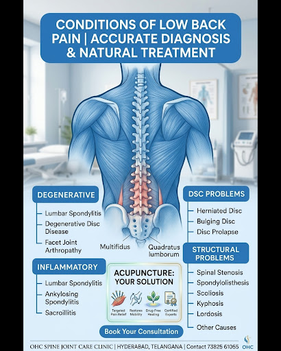 Experiencing low back pain can truly affect your daily life, making even simple movements a strug… post image