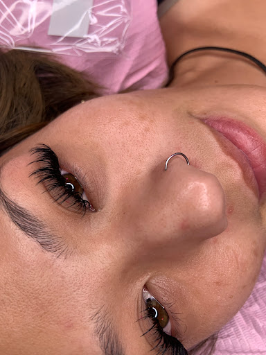 ROSEGLOW ESTHETIX - Thumbnail