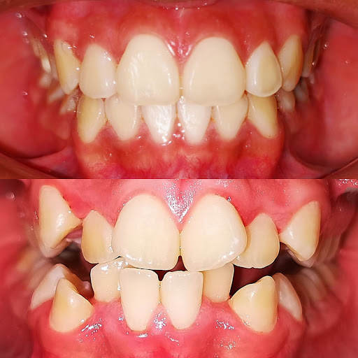 COE Clínica Dental Ocuiltzapotlan - Thumbnail