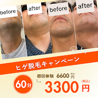 脱毛サロン laulau