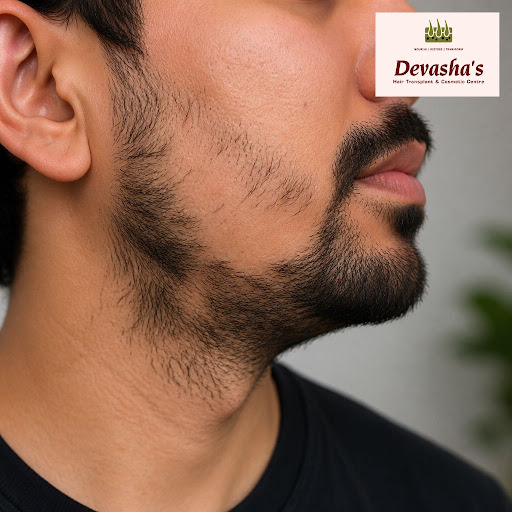 Struggling with a thin or uneven beard? At Devasha's Hair Transplant And Cosmetic Centre - Dr. Ja… post image