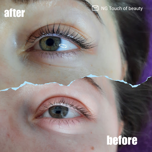 NG Touch of beauty