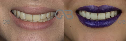 CAB Rehabilitacion oral e implantes - Thumbnail