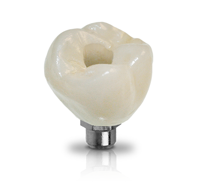 Ezcad Dental Lab