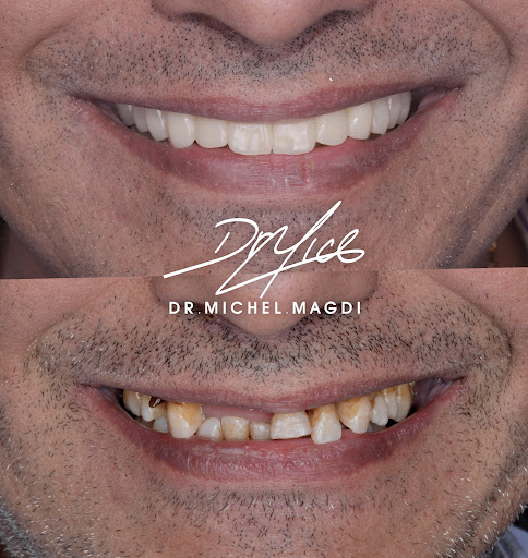 عيادة إنفنتي لطب وتجميل الأسنان ( د. محمد سمير أحمد) - صورة 5