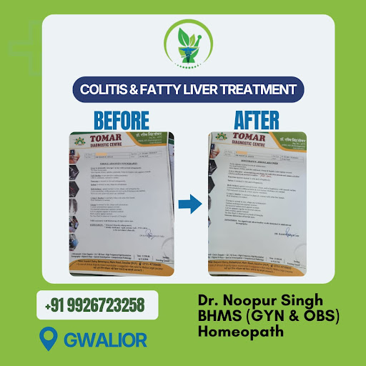 🌿 Colitis & Fatty Liver Recovery: Real Results with Homeopathy! 🌿 post image