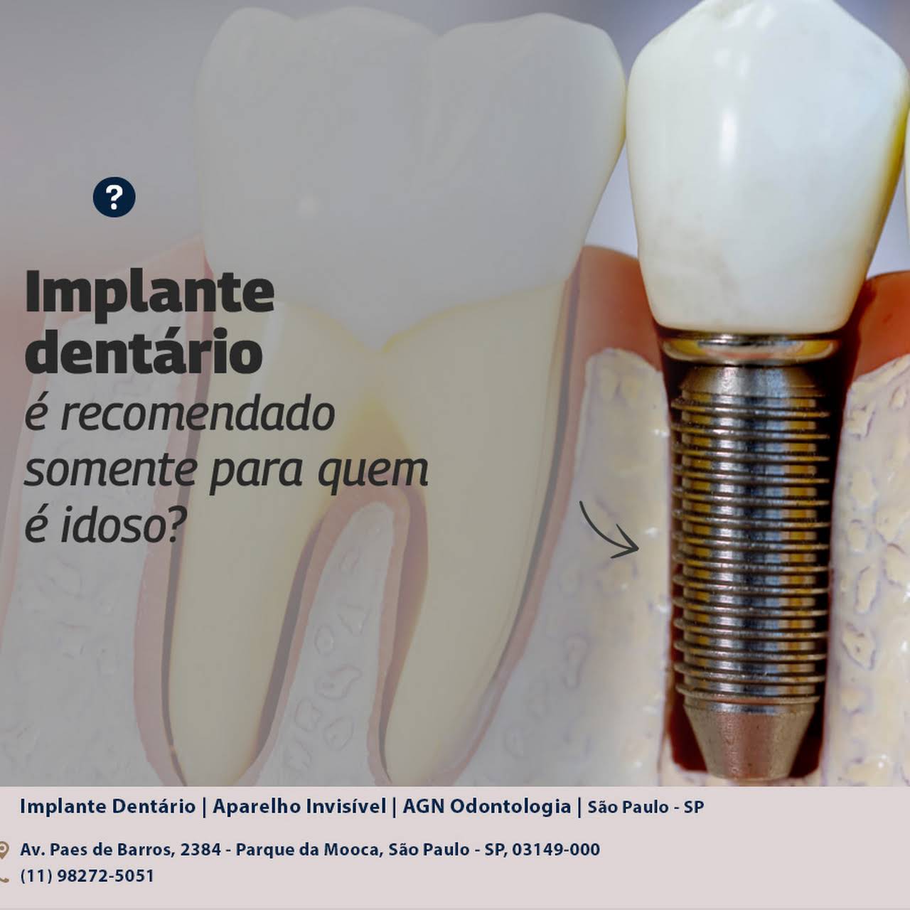 jogar Operate Now Immplante Dentário no