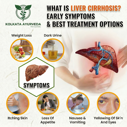 Liver Health Matters: Understanding Liver Cirrhosis 🌿 post image
