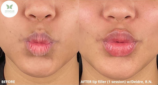 Reneux Med & Day Spa