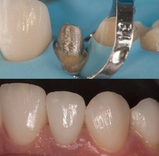 Barone Failla Odontoiatria - Thumbnail