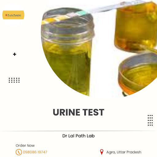Urine Test post image