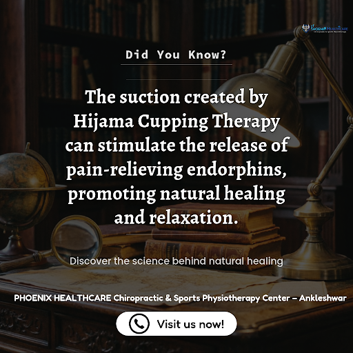 Hijama Cupping Therapy post image
